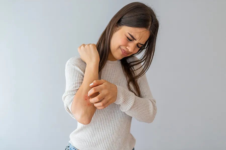 Eczema-Clinic A young brunette woman scratches her forearm and winces in discomfort. Get treatment for eczema from Dr. Donna Diamond in Louisville/Boulder.
