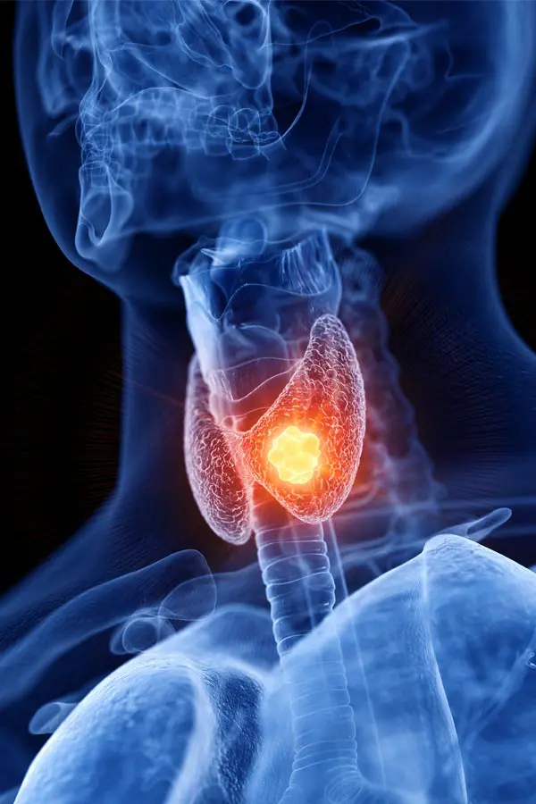 Thyroid-Imbalance-Treatment A 3D illustration of an x-ray of a human neck, highlighting the thyroid. Get help with thyroid imbalance from Dr. Donna Diamond in Louisville/Boulder.